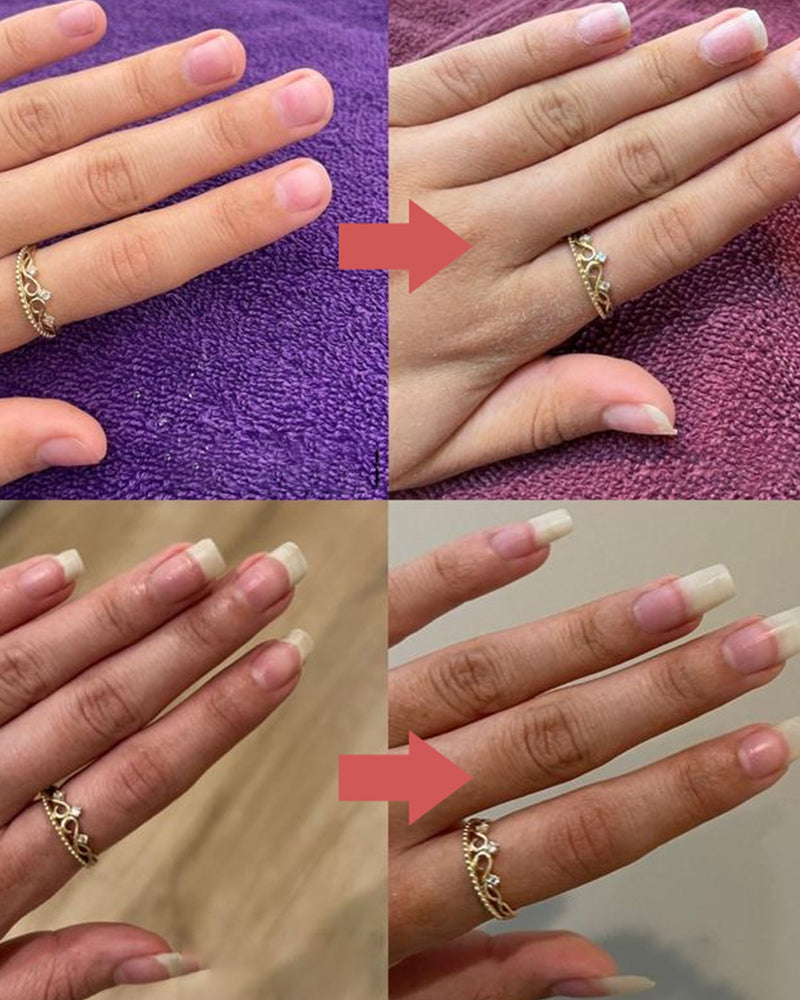 Nails nutritious growth oil